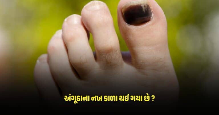 Nail Care Tips: અંગૂઠાના નખ કાળા થઈ ગયા હોય તો તેને સાફ કરવા માટે અપનાવો આ રીતો