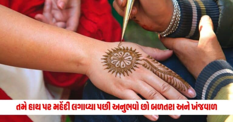 Mehndi Tips: તમે હાથ પર મહેંદી લગાવ્યા પછી અનુભવો છો બળતરા અને ખંજવાળ, તો અપનાવો આ ઘરગથ્થુ ઉપાયો