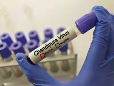 Chandipura Virus : ગુજરાતમાં 'ચાંદીપુરા વાયરસ'નો કહેર વધ્યો, એક મહિનામાં 28 બાળકોના મોત