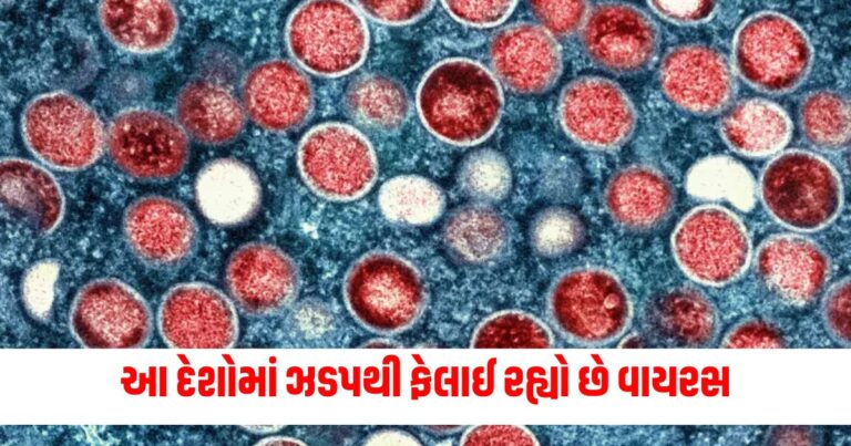 Mpox Outbreak, Monkeypox, ડબલ્યુએચઓ, વર્લ્ડ હેલ્થ ઓર્ગેનાઇઝેશન, હેલ્થ ન્યુઝ,WHO, World Health Organization, Health News