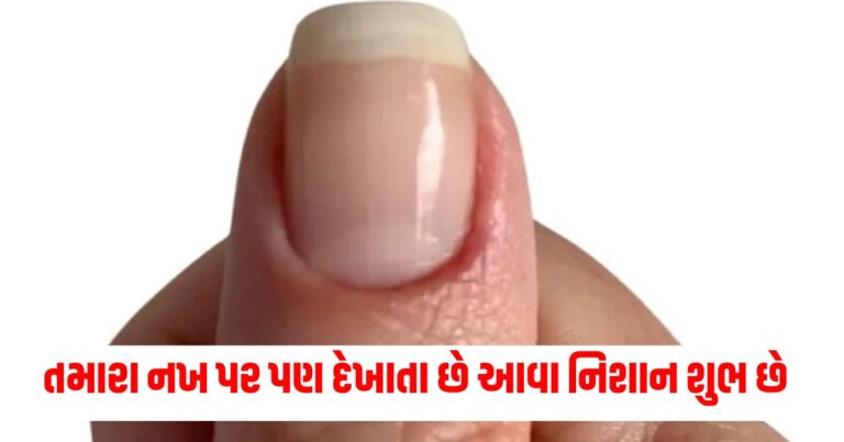 Samudrik Shastra, Samudrik Shastra,Spirituality,White Spot on Nails,Mark On Nails,નખ પરના નિશાન, નખ પરના ડાઘ, સમુદ્રશાસ્ત્ર