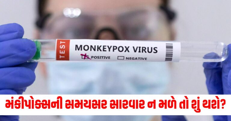 Health News, Monkeypox vaccine, infectious disease, threat of monkeypox,