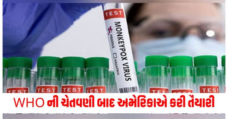 MPox , મંકિપોક્સ લક્ષણો, Monkeypox Guidelines, મંકિપોક્સ,