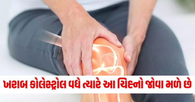 કોલેસ્ટ્રોલ