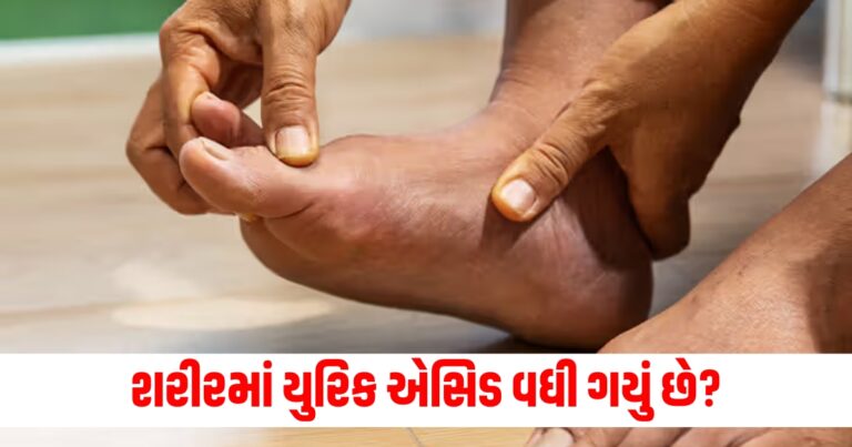 Uric Acid Treatment, Ayurvedic Remedies, High Uric Acid, Natural Uric Acid Reduction, Ayurveda for Gout, Herbal Remedies for Uric Acid,